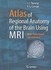 Book: Atlas of Regional Anatomy of the Brain Using Mri Hans O. (FWD) Luders, Paperback